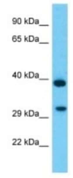 TMEM177 Rabbit anti-Human, Polyclonal, Novus Biologicals 100 &mu;g | Buy Online | Novus Biologicals | Fisher Scientific